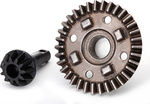 Traxxas 11T / 34T differenciálmű hajtóművek